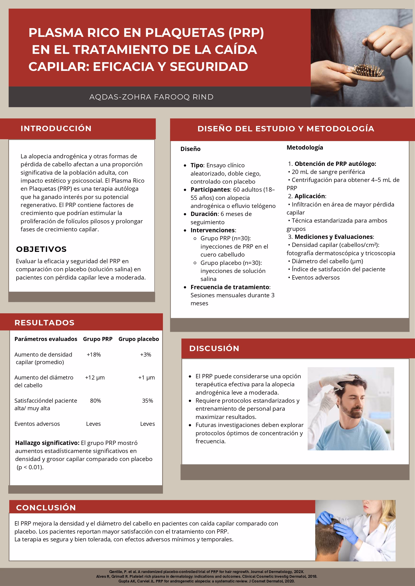 PRP en caída capilar - AQDAS-ZOHRA FAROOQ RIND - Poster SEED